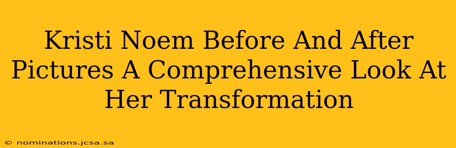 Kristi Noem Before And After Pictures A Comprehensive Look At Her Transformation
